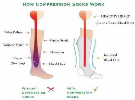 Compression Socks for Men and Women - Support Stockings ~ 9 Colors